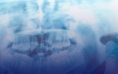 Radiografias e Tomografias – CDI Dental